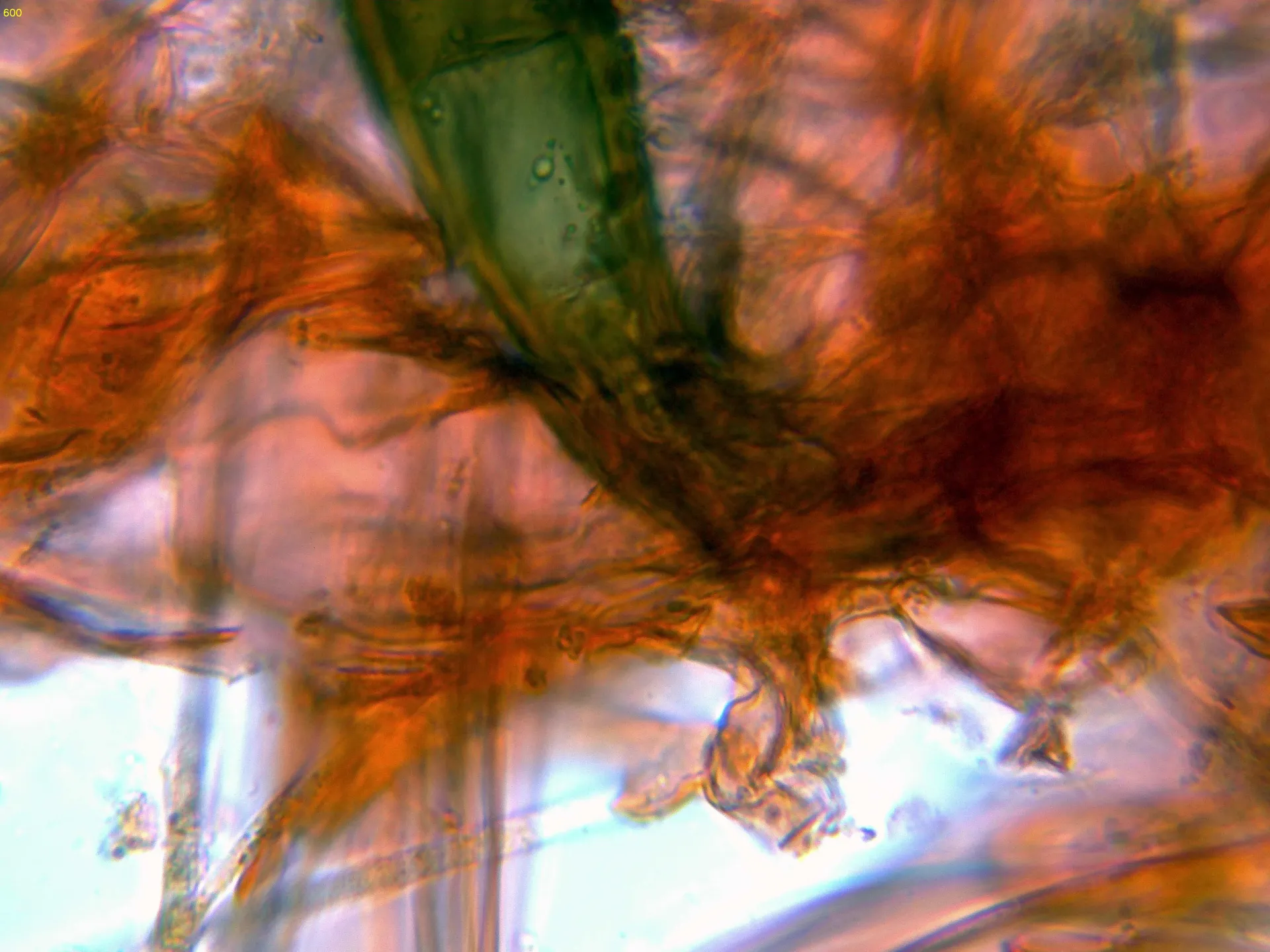 Microscopía de Scutellinia crinita - 10 - Base pelos-009